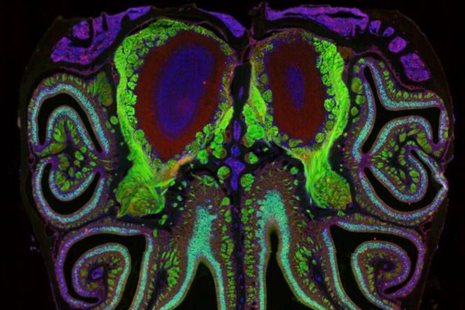 Muestra microscópica de la nariz de un ratón modificada para mostrar neuronas relacionadas con el olfato. Foto: DATTA LAB. 