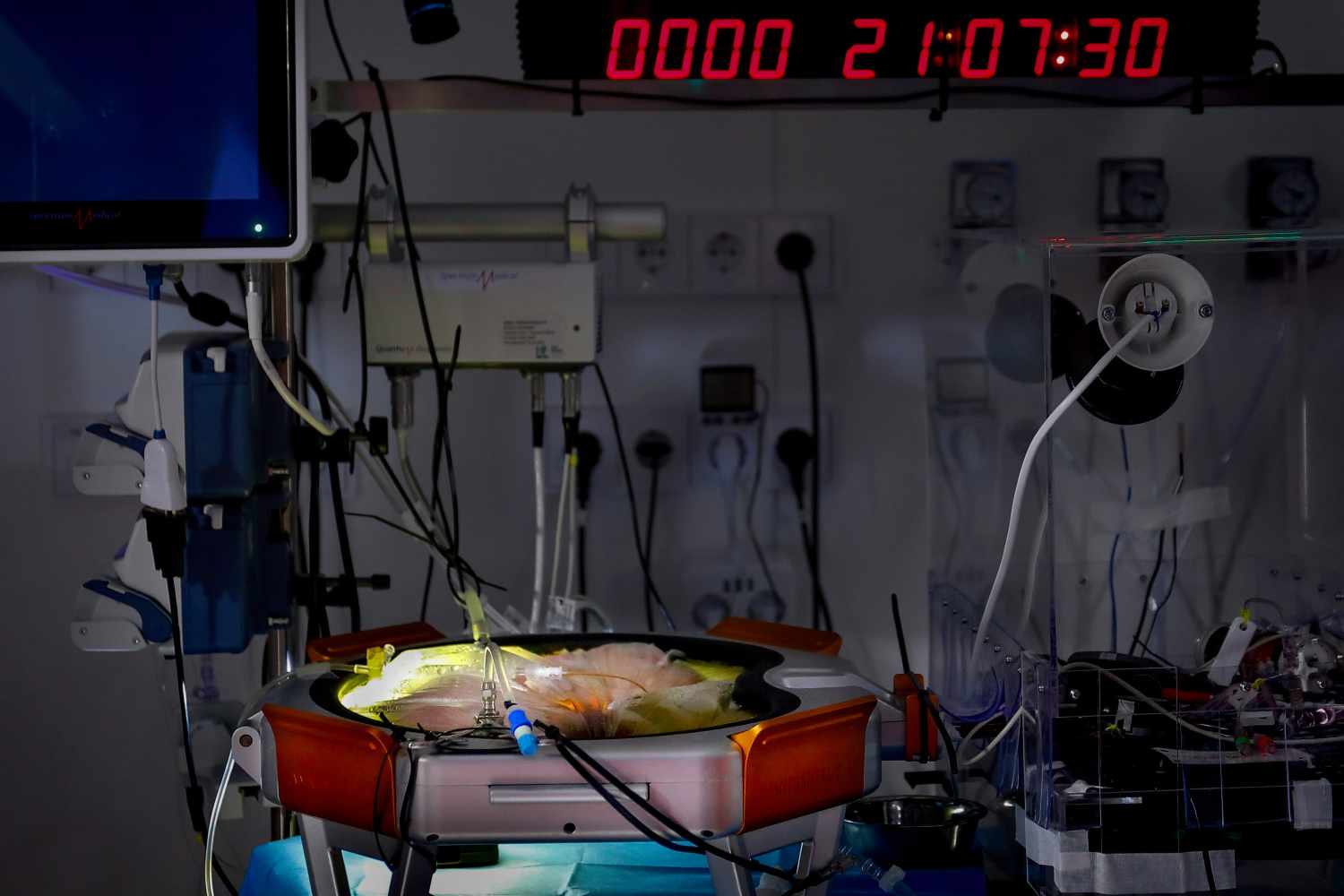 Placenta artificial de BCNatal logra supervivencia de 21 días en modelo animal