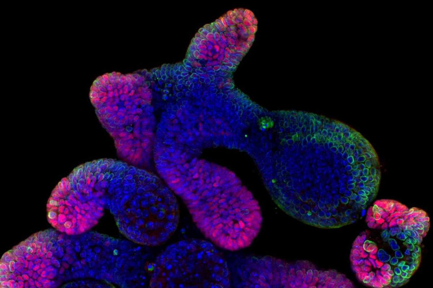 KDAS: un potencial aliado frente a la enfermedad inflamatoria intestinal