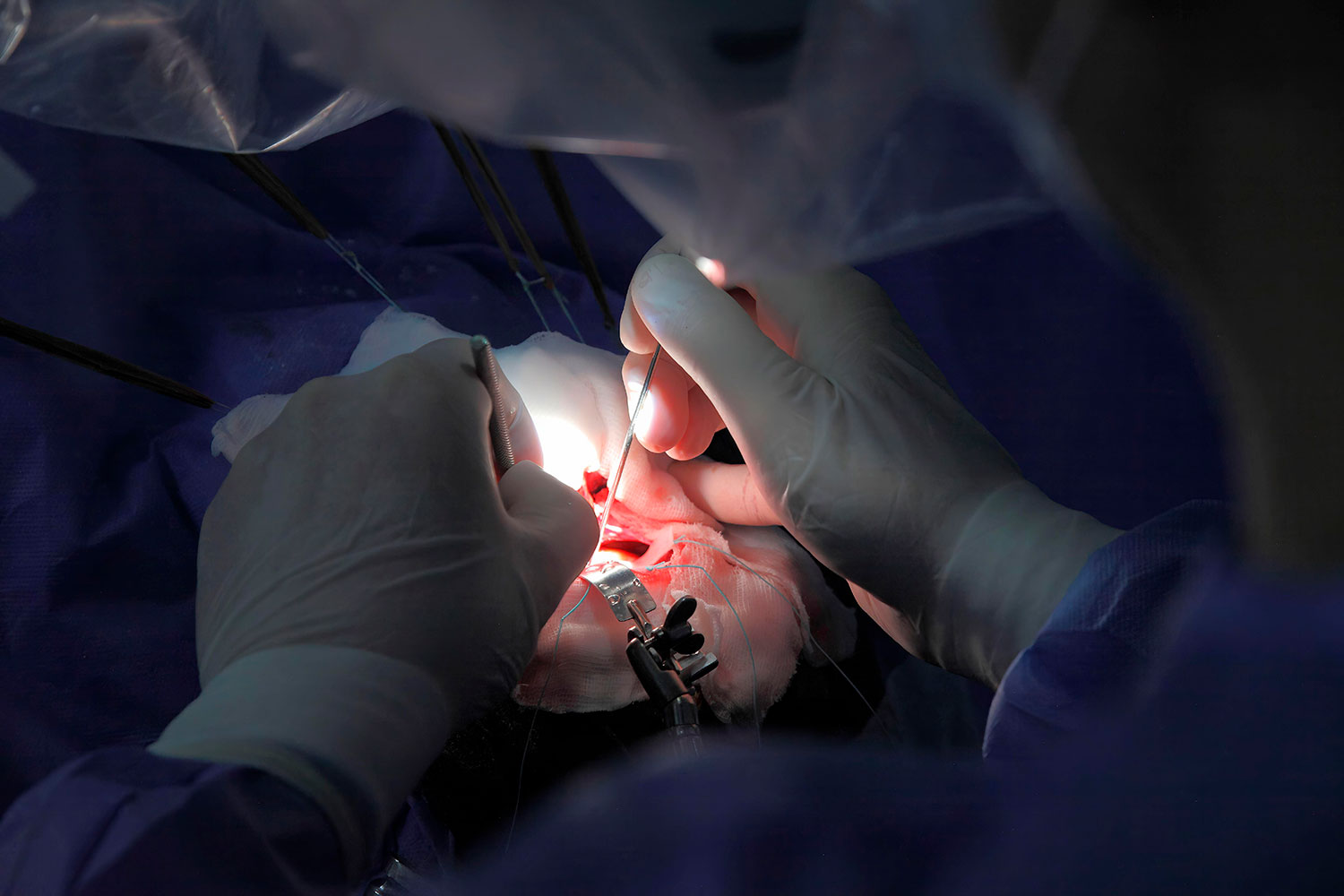 La edad, un factor "más" en neurocirugía