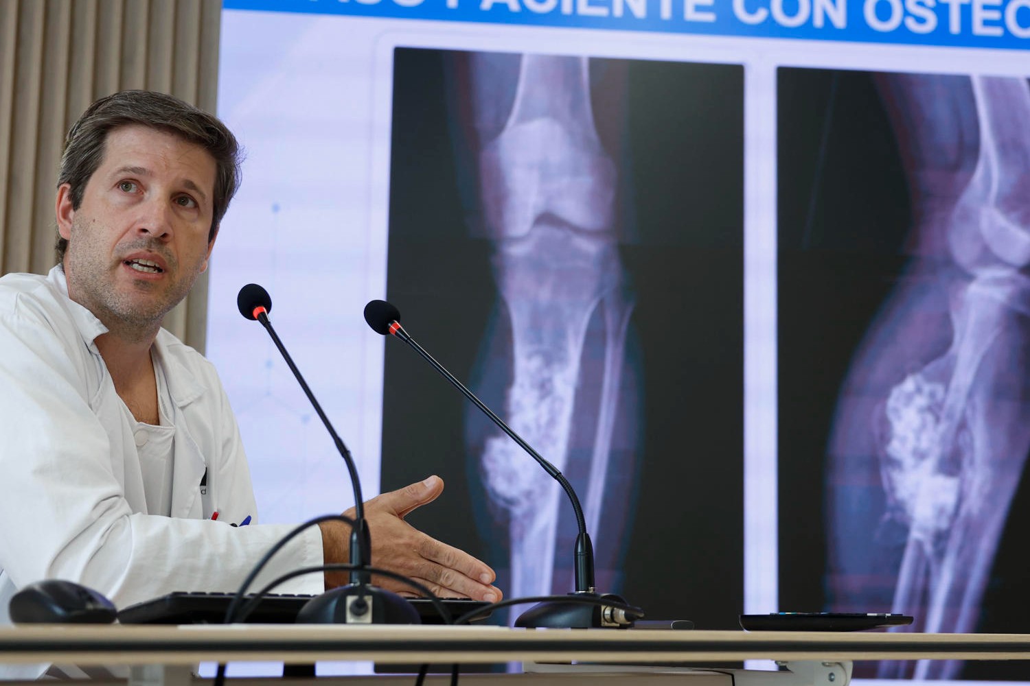 El Gregorio Marañón fabrica e implanta la primera prótesis ósea de metamaterial del mundo