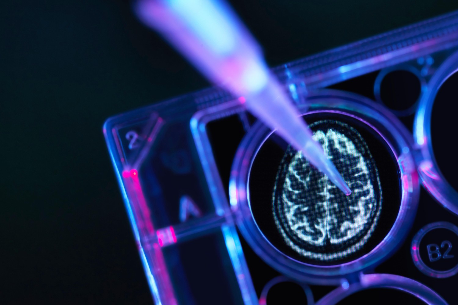 Un atlas de 1,3 millones de células revela los periodos críticos del cerebro humano
