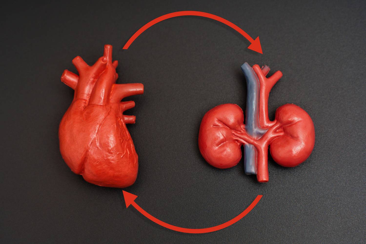 Las complicaciones cardiorrenales de la diabetes tipo 2 se disparan con el tiempo
