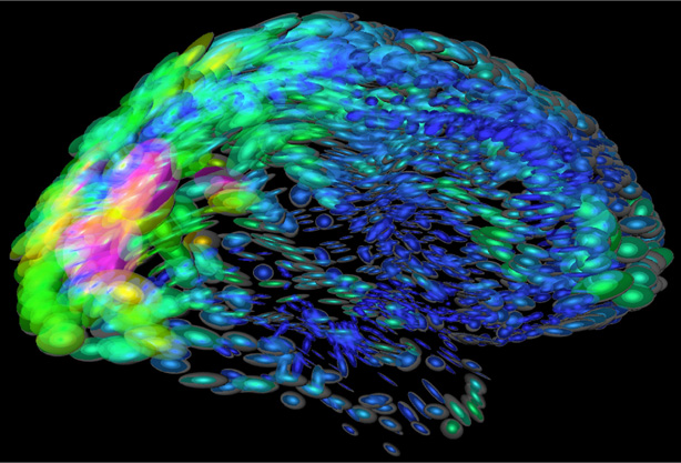 Los organoides cerebrales ganan realismo gracias a una nueva plataforma experimental en ratón