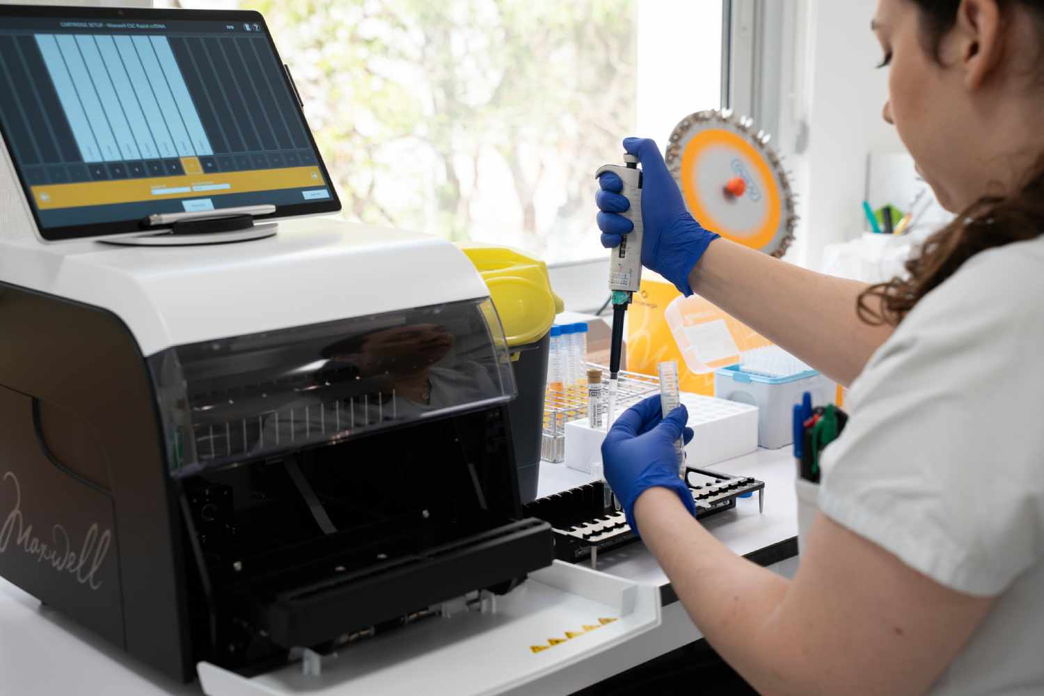 Bellvitge reduce biopsias postrasplante cardíaco gracias a la genómica