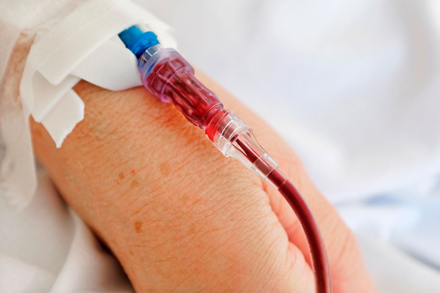 La transfusión de sangre a domicilio, un procedimiento en expansión
