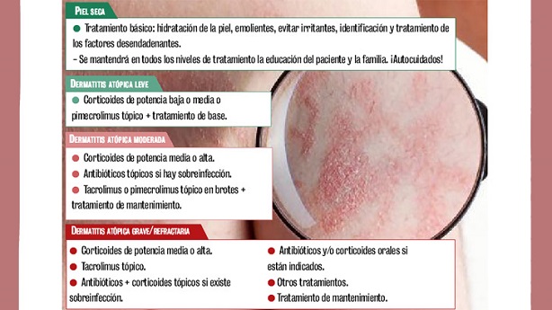 Es Buena La Nivea Para La Dermatitis Atópica