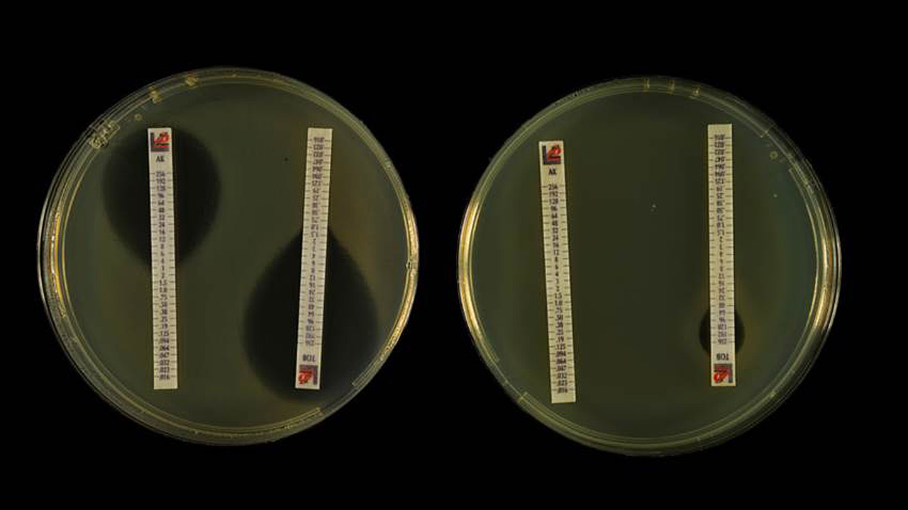 En la foto se muestra la inhibición del crecimiento bacteriano que producen los antibióticos. El tamaño de los halos indica si una bacteria es sensible o resistente. Izquierda, sensible; derecha, resistente. 