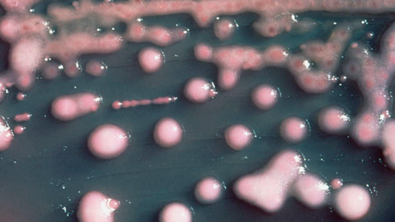 Cultivo de la bacteria 'Klebsiella pneumoniae'. 