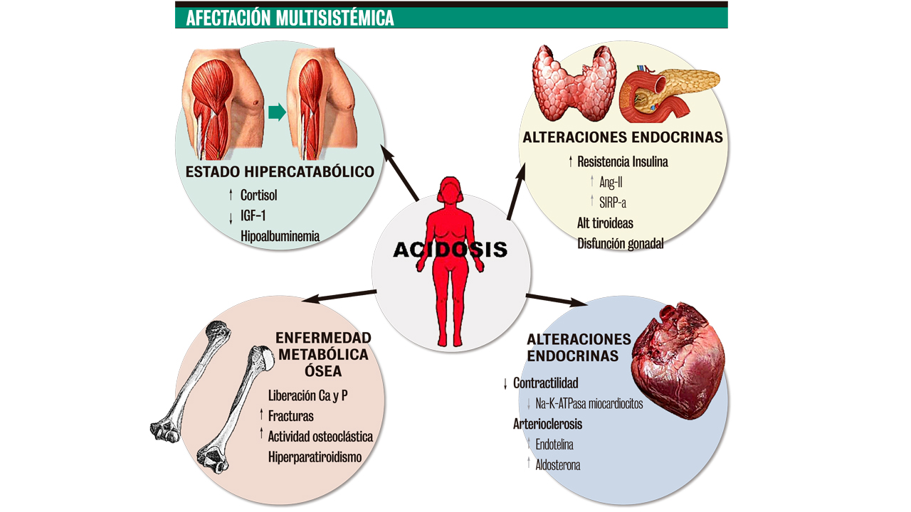 acidosis metabolica 