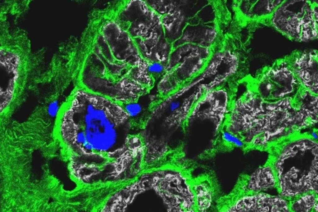 Inmunofluorescencia de tejido cardiaco dañado: los límites celulares en verde; núcleos, en azul y el músculo cardíaco en gris. Foto: UNIVERSIDAD DE ALBERTA.