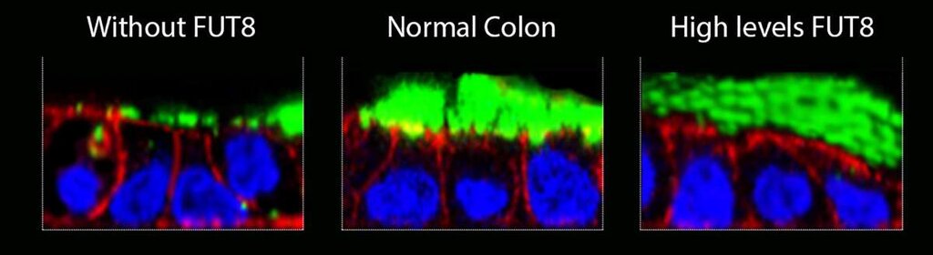 Detalle de la mucosa alterada en casos de colitis ulcerosa. Foto: CRG