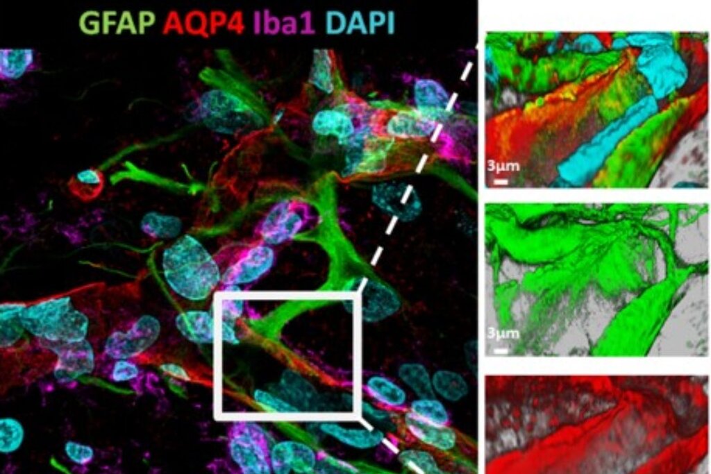 Imagen obtenida por microscopía confocal ilustrando el mantenimiento de la barrera hematoencefálica tras un ictus isquémico en un cerebro de una rata tratada con metoprolol intravenoso pre-reperfusión. Foto: CNIC.