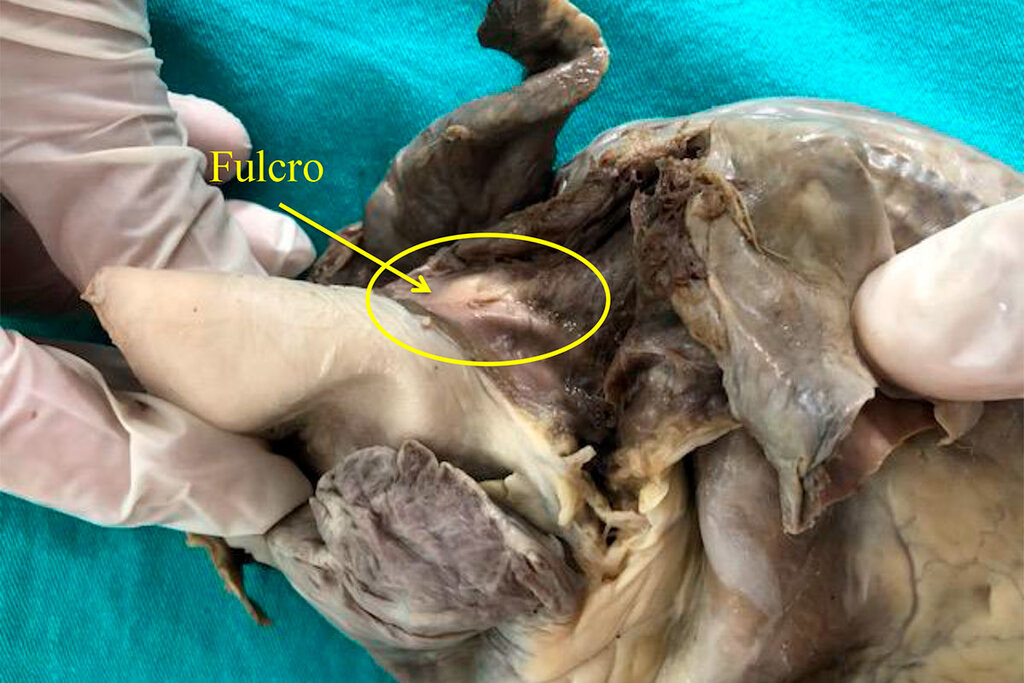 Fulcro en un corazón humano adulto.