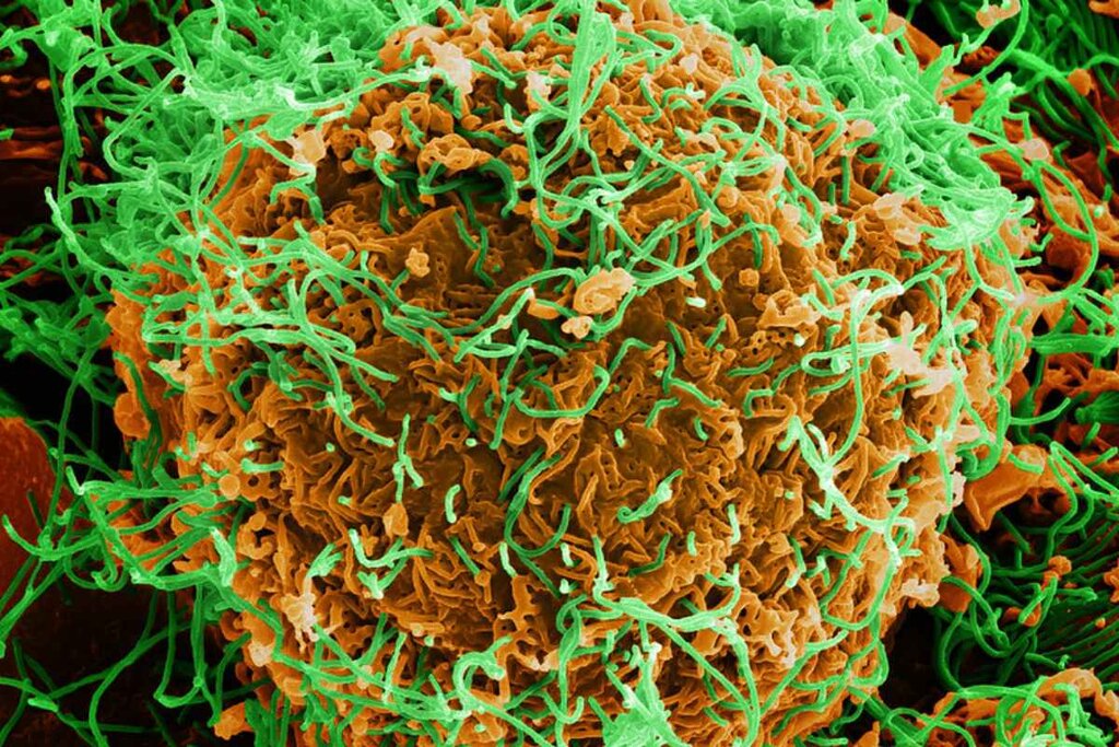 Micrografía del virus del Ébola. Foto: NIAID.