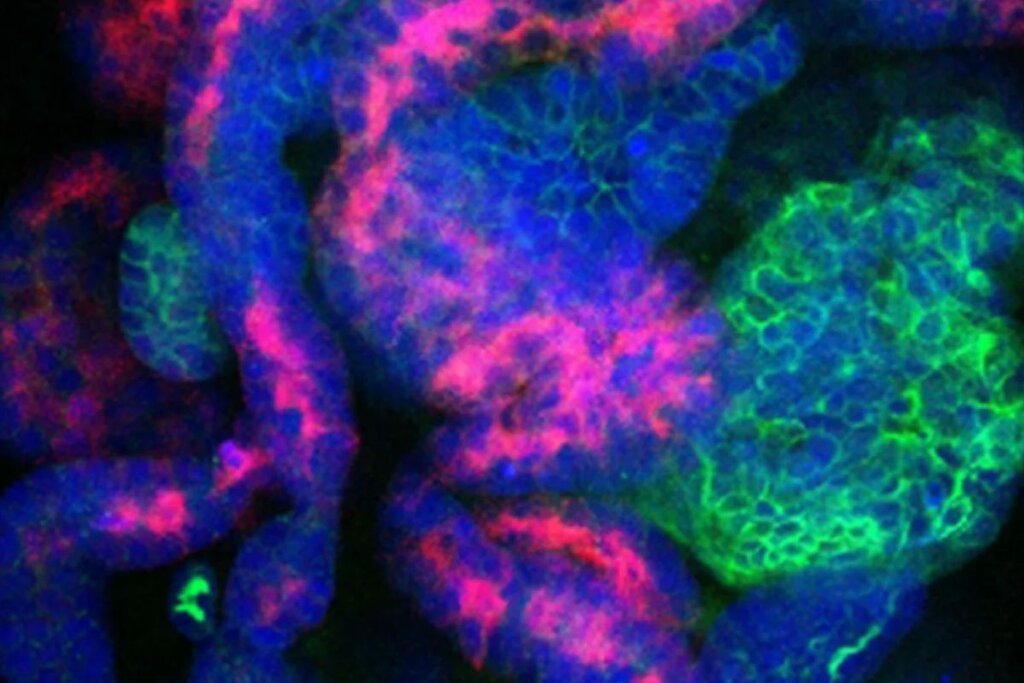 Imagen de células precursoras de nefronas. Foto: DM. 