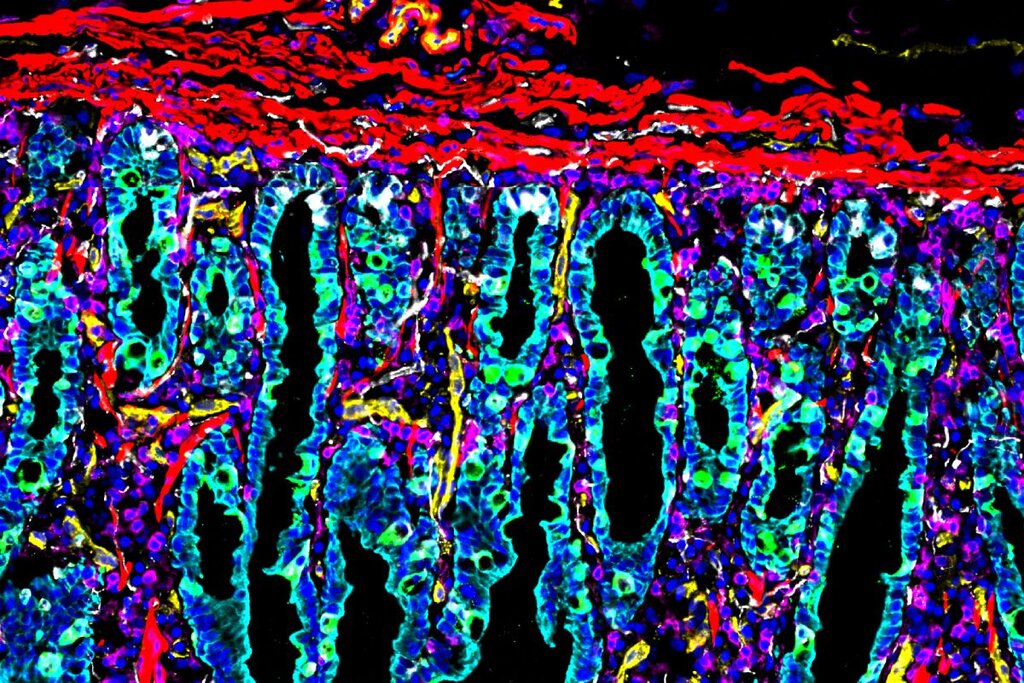 La combinación de microscop�a y tecnolog�a robótica ofrece imágenes que son una ventana al intrincado mundo de la diversidad celular intestinal. Foto: STANFORD MEDICINE/Laboratorios SNYDER/NOLAN/GREENLEAF. 