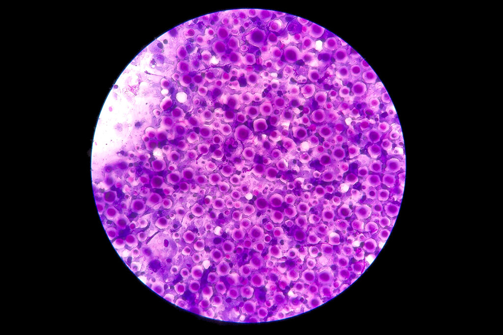 El hongo 'Cryptococcus neoformans'. Imagen: SHUTTERSTOCK.