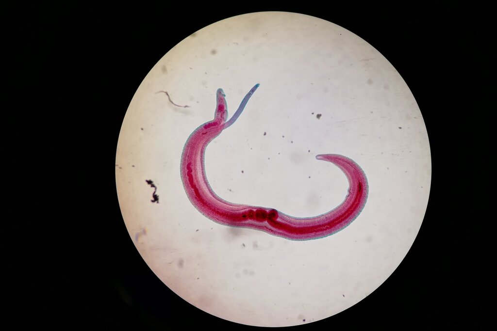 Ya se han detectado brotes autoctónos de 'schistosomiasis' en Almería. Foto: SHUTTERSTOCK.