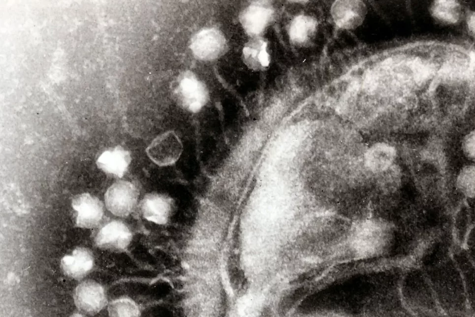 Imagen de microscopía electrónica que muestra un grupo de virus bacteriófagos acoplados en una célula bacteriana. FOTO: Graham Beards-Wikipedia. CSIC.