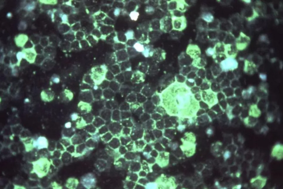 Virus respiratorio sincitial bajo microscopía de inmunofluorescencia. Foto: C. LYERLA | CDC