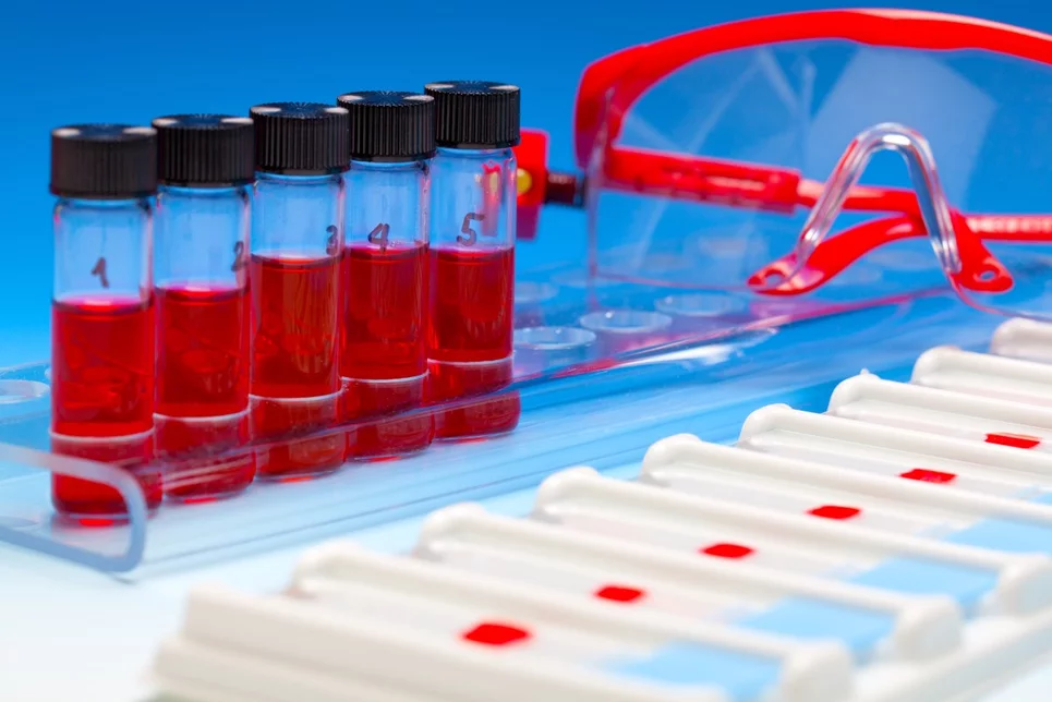 la detección de material genético del tumor en la sangre puede servir para seleccionar qué pacientes tienen más riesgo de recaer. Foto: SHUTTERSTOCK.