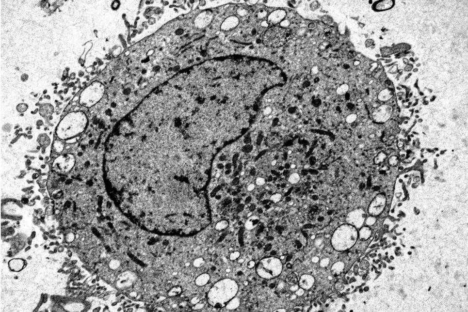 Una célula mastocito vista al microscopio muestra su núcleo.