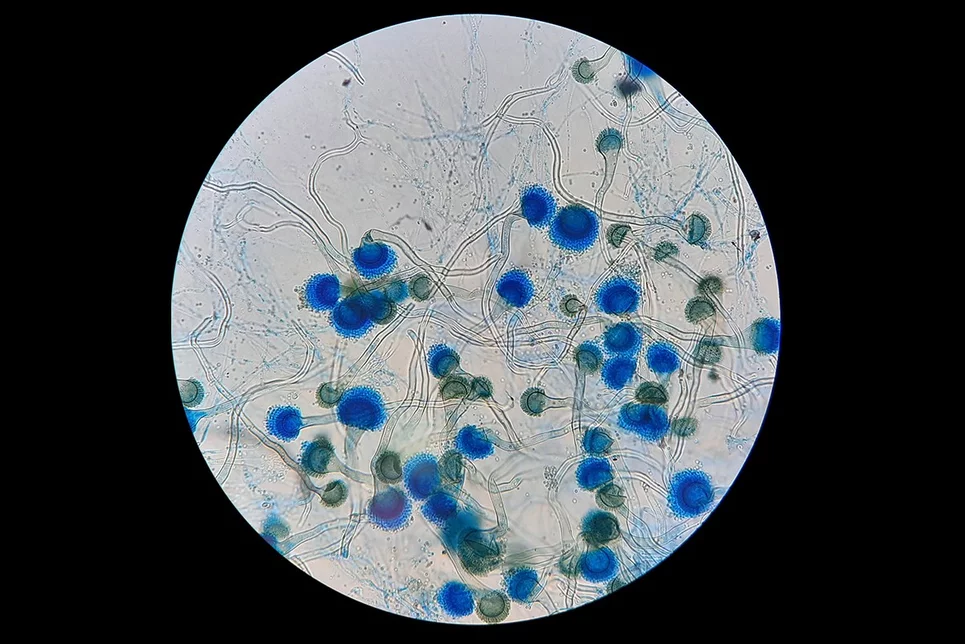 Imagen microscópica de 'Aspergillus fumigatus'. Foto: SHUTTERSTOCK
