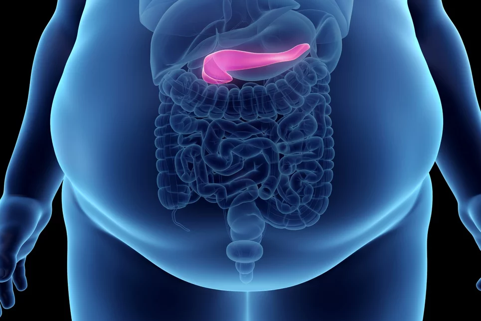 Un IMC alto se asocia a un alto porcentaje de grasa hepática y pancreática, pero no necesariamente con el porcentaje de tejido adiposo visceral. Foto: SHUTTERSTOCK.