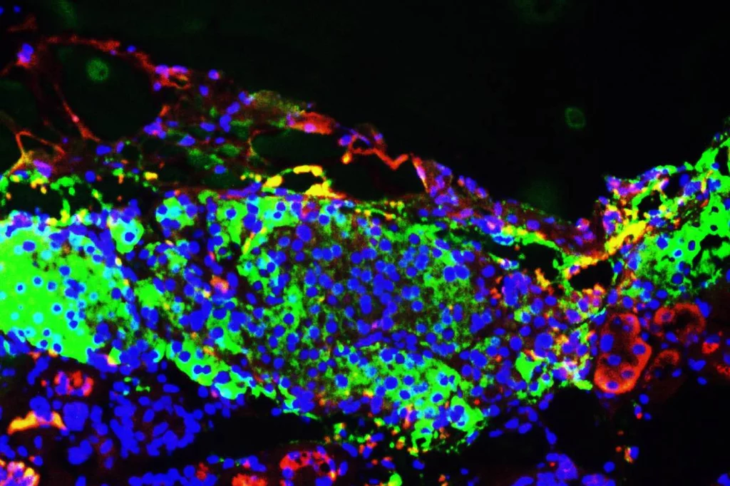 Células beta pancreáticas derivadas de células de pluripotencialidad inducida.