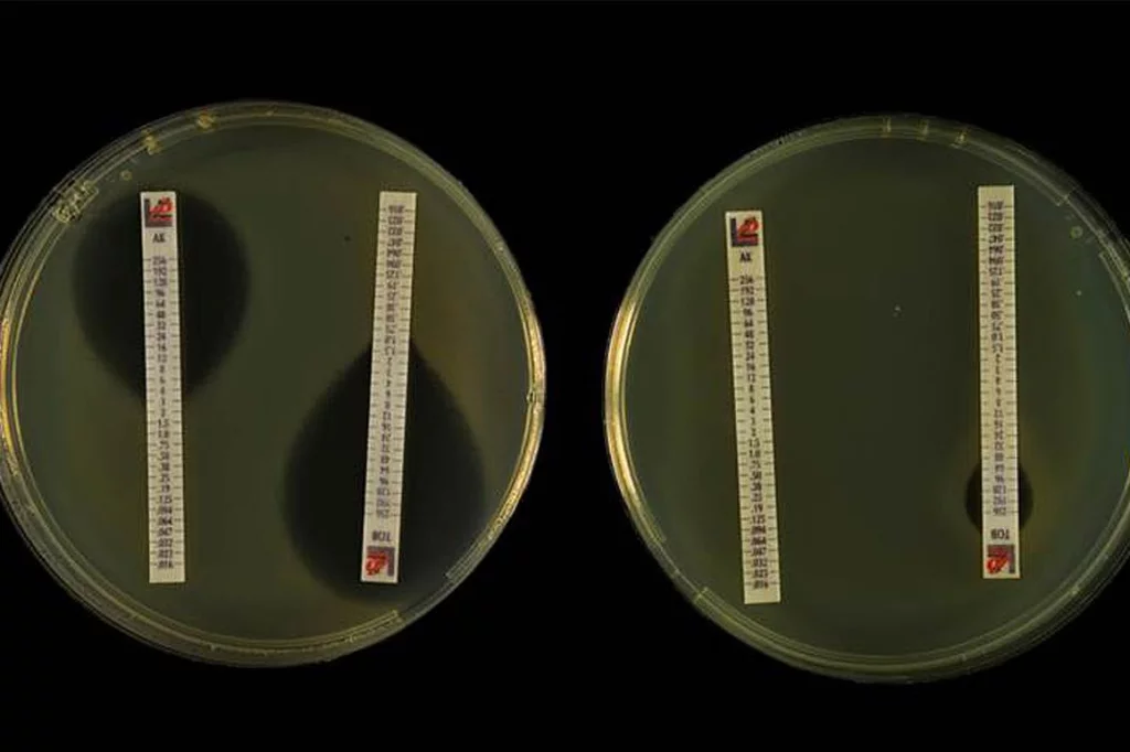 El crecimiento de las resistencias bacterianas crece en España. FOTO: DM. 