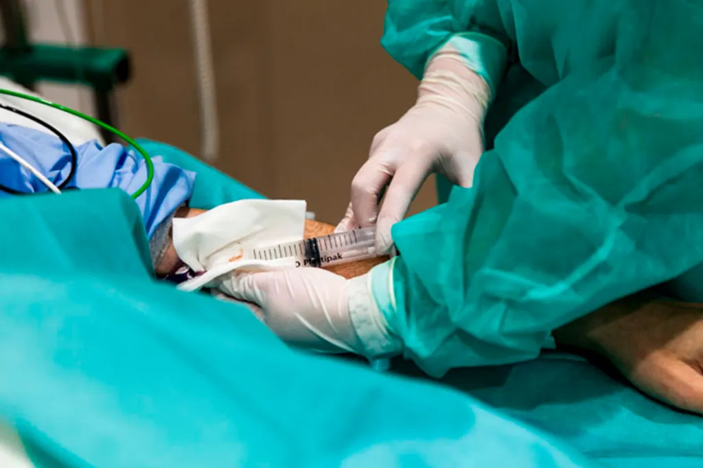 Infusión de terapia CAR-T a un paciente en el Hospital Vall d'Hebron de Barcelona. (Jaume Cosialls)