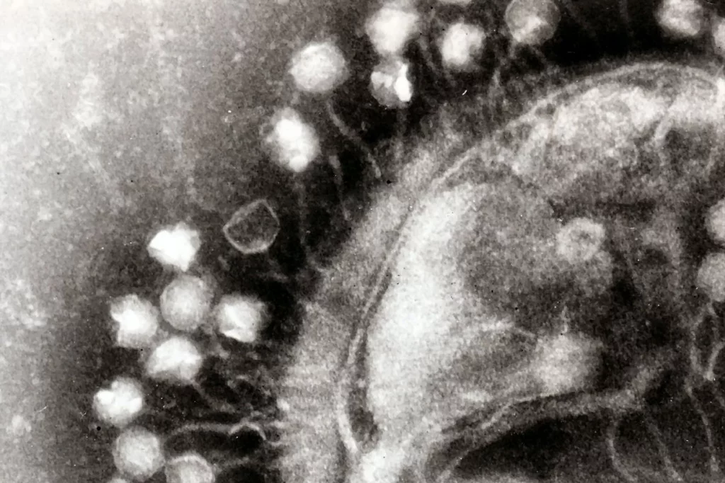 Imagen de microscopa electrónica que muestra un grupo de virus bacteriófagos acoplados en una célula bacteriana. FOTO: Graham Beards-Wikipedia. CSIC.