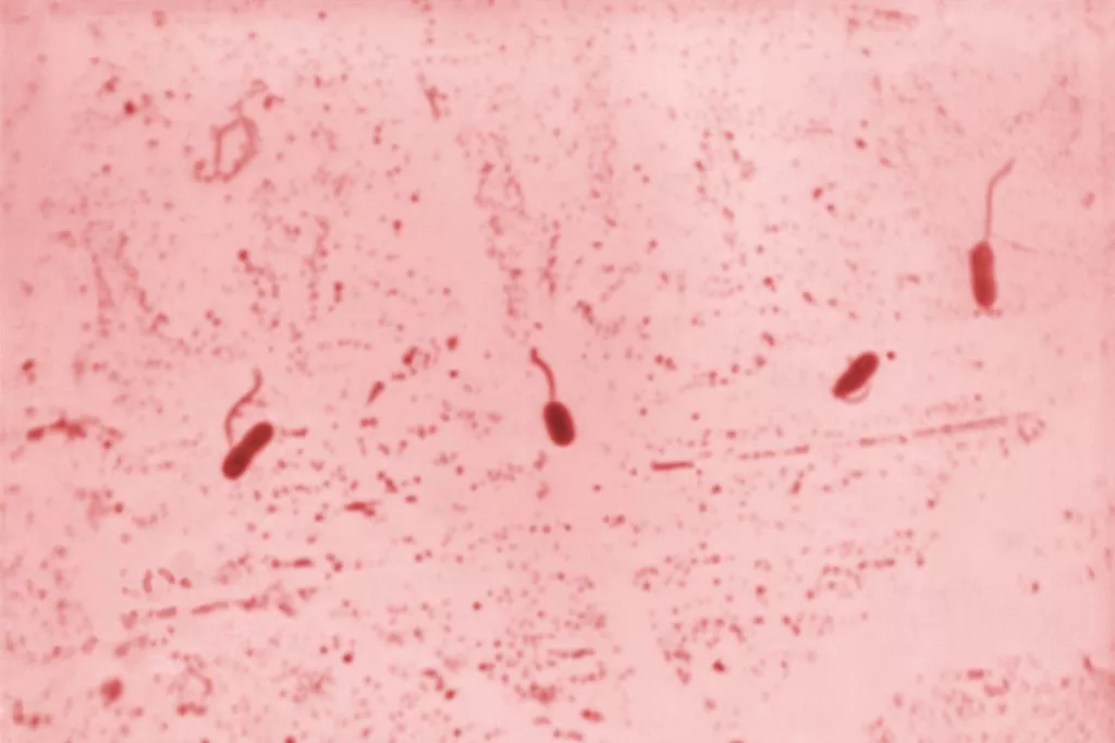 La bacteria 'Vibrio cholerae' bajo el microscopio. Foto: CDC