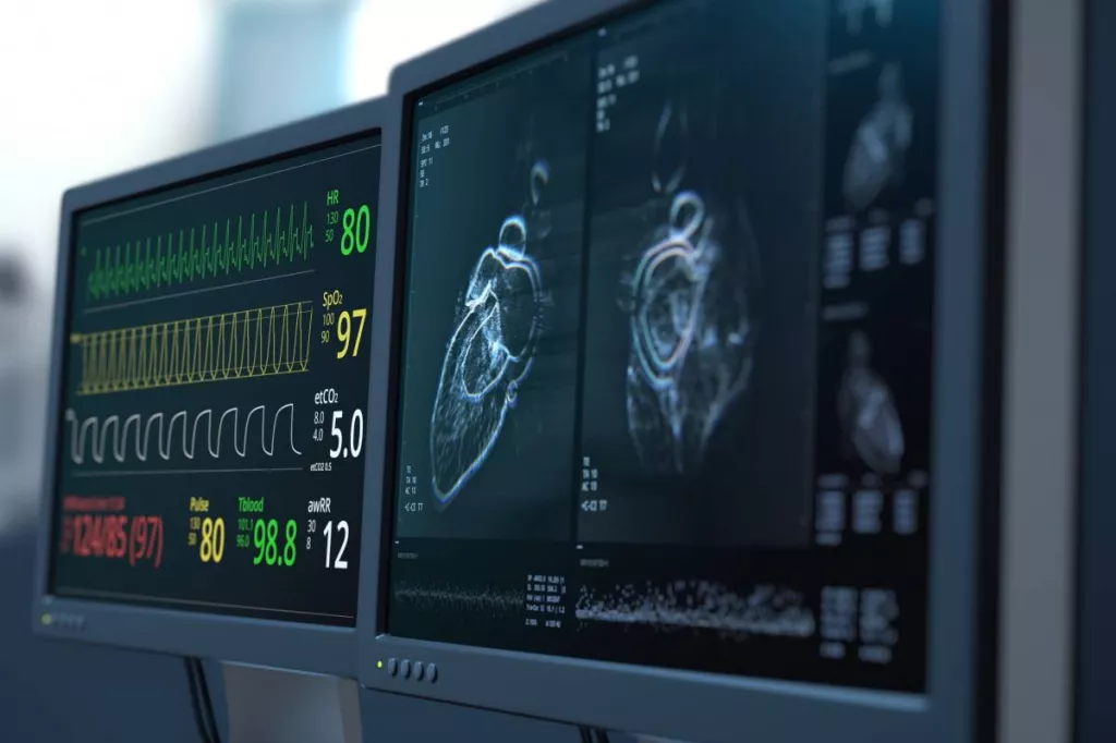 La transición al alta en pacientes con insuficiencia cardiaca debe empezar durante la hospitalización.