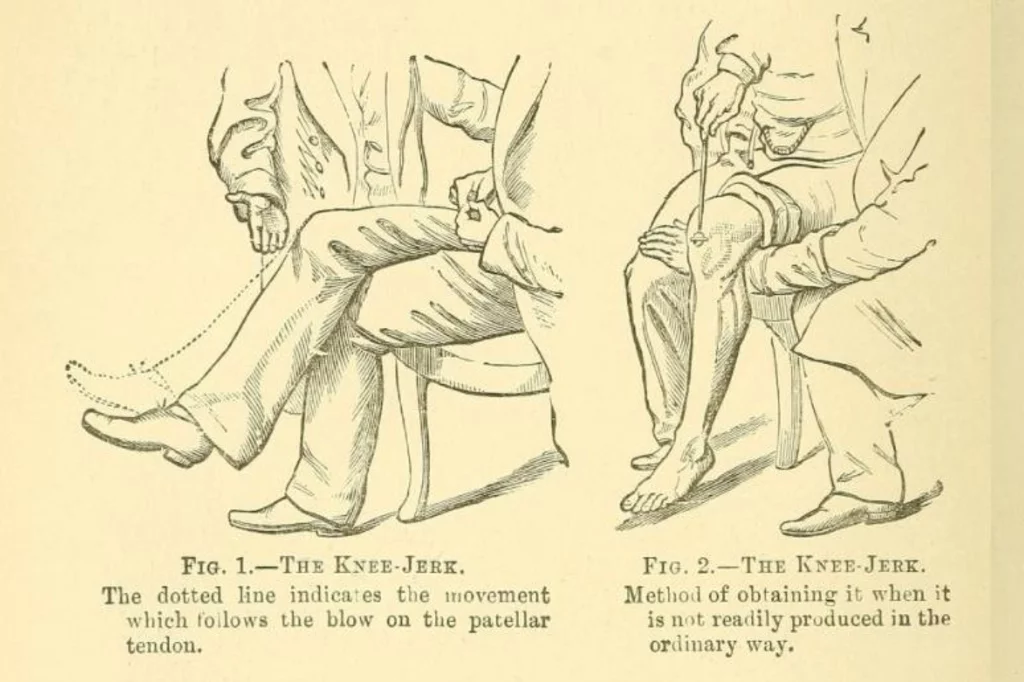 al percutir el tendón rotuliano, se contrae el músculo cuádriceps y se produce la extensión de la rodilla.