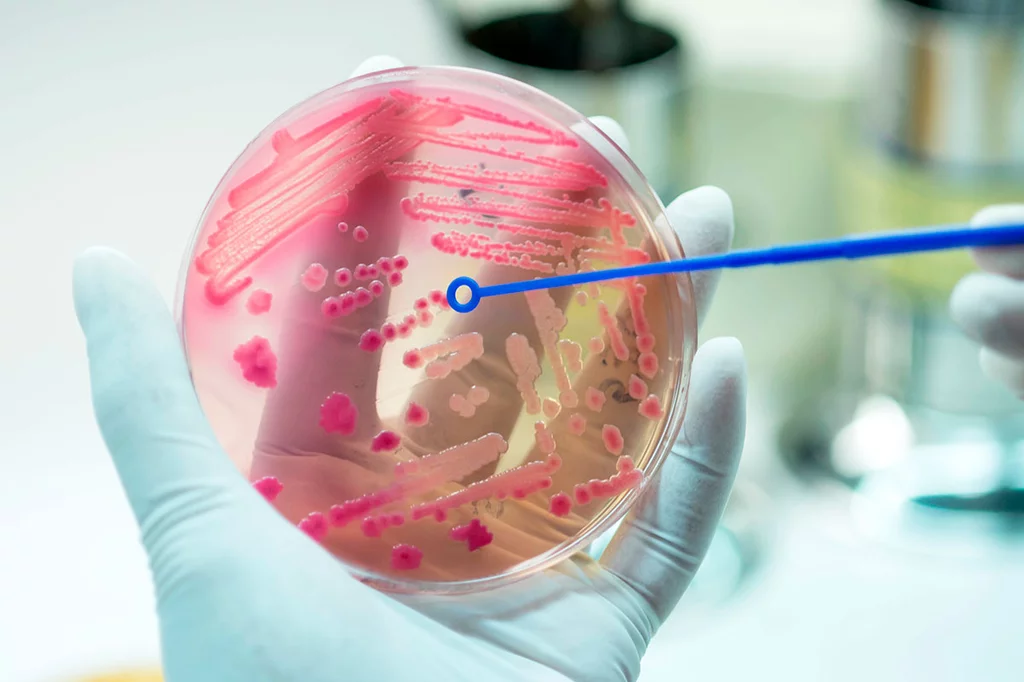 Placa de hemocultivo para el diagnóstico microbiológico de una septicemia.