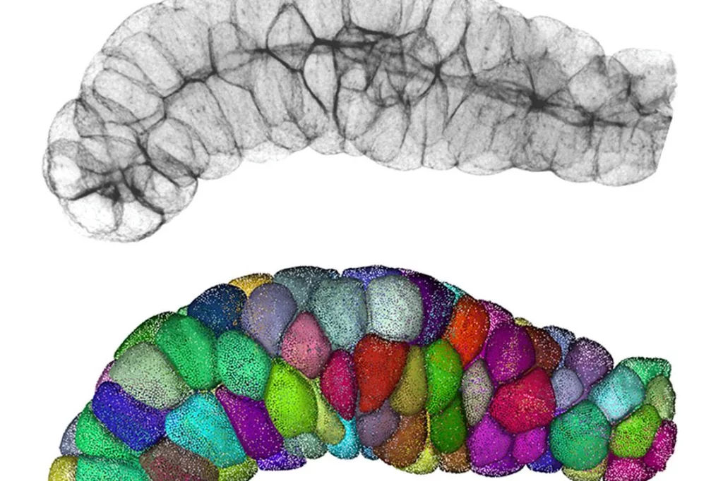 Tejido glandular en una imagen proveniente del microscopio; debajo, la imagen procesada por ordenador para poder cuantificar las propiedades.