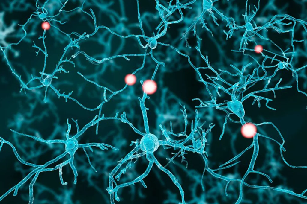 La estimulación cerebral con ondas de choque incide sobre la plasticidad neuronal. Foto: AGEFOTOSTOCK. 