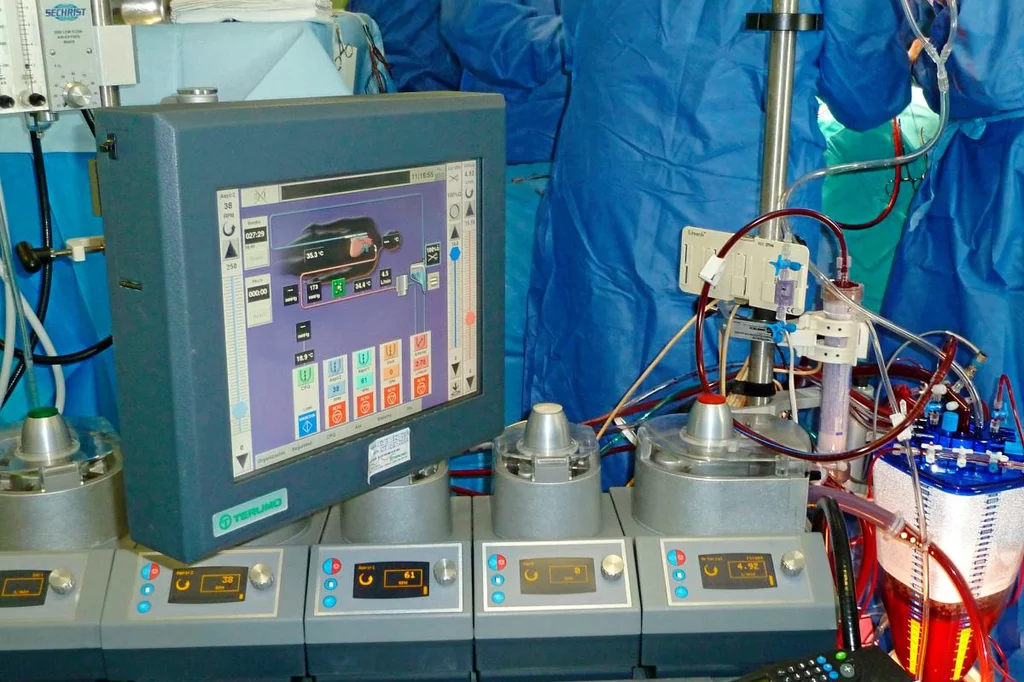 Soporte de oxigenación por membrana extracorpórea (ECMO). Foto: DM