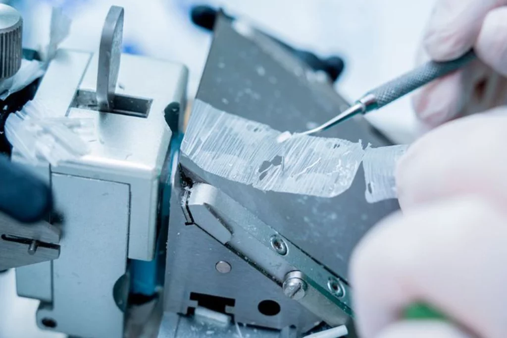 El desarrollo de tejidos artificiales permite abordar algunas alteraciones. Foto: DM.  