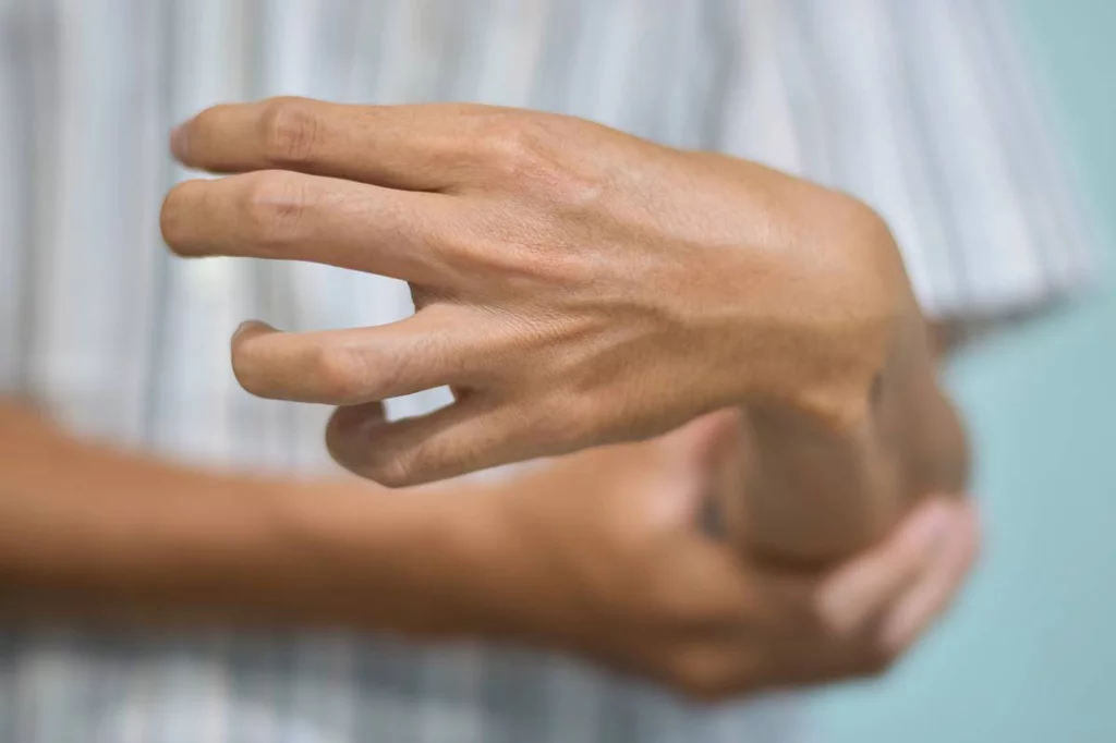 La mexiletina está indicada para el tratamiento sintomático de la miotona en pacientes con trastornos miotónicos no distróficos. Foto: SHUTTERSTOCK.