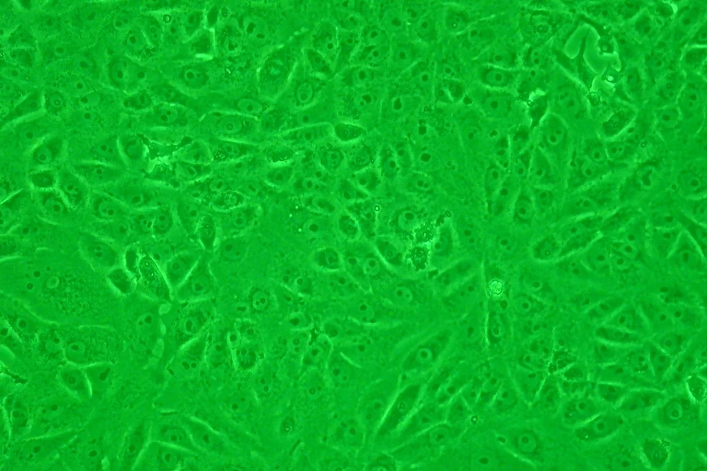 Las células Vero constituyen una de las estirpes celulares continuas de mam�fero más empleadas en las investigaciones microbiológicas y de biolog�a molecular y celular.