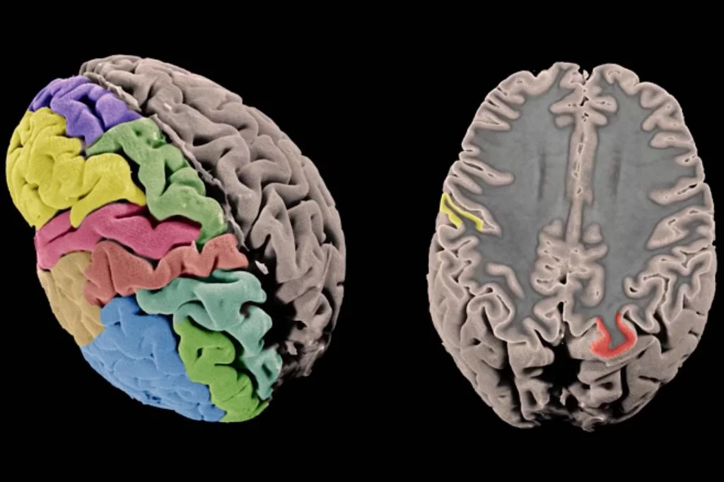 Ciertos genes explican diferencias del Parkinson entre hombres y mujeres. Foto: DM. 