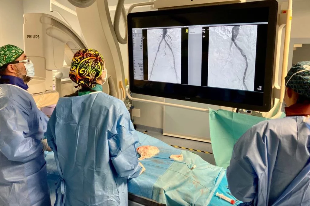 La cirugía endovascular es una opción en ciertos pacientes con EAP. Foto: DM. 