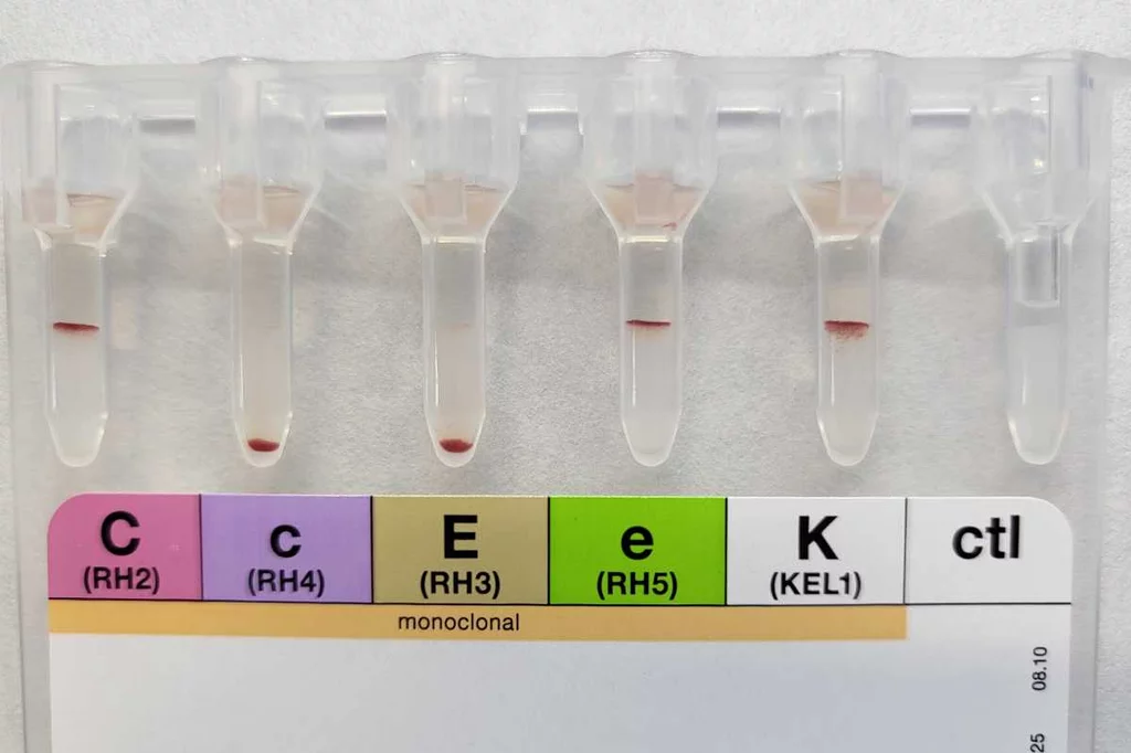 Tarjeta con fenotipos de sangre del BST de CataluÃ±a. Foto: BANC DE SANG I TEXITS