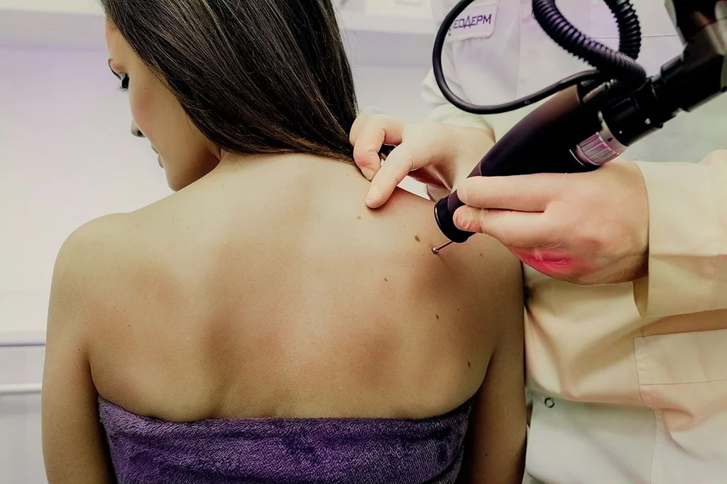 Dermatología agota sus plazas el segundo día de adjudicación. 