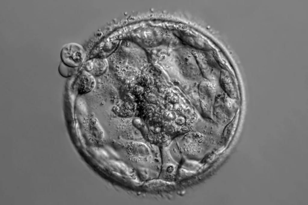 Embrión humano aislado en fase blastocista.