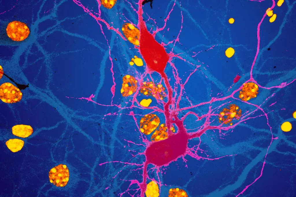 Detalle de la fusiÃ³n neuronal observada por los investigadores. Foto: R.MARTÃNEZ-MÃRMOL | N. VALMAS