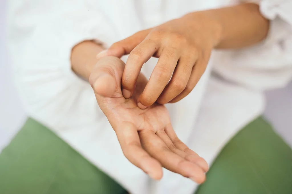 Una mujer se rasca las manos tras una exposiciÃ³n a productos quÃmicos. Foto: SHUTTERSTOCK